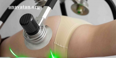 Soğuk Lipoliz Nedir? Etki Ne Zaman Başlar?