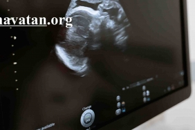 Ultrason Nedir ve Neden Çekilir? 